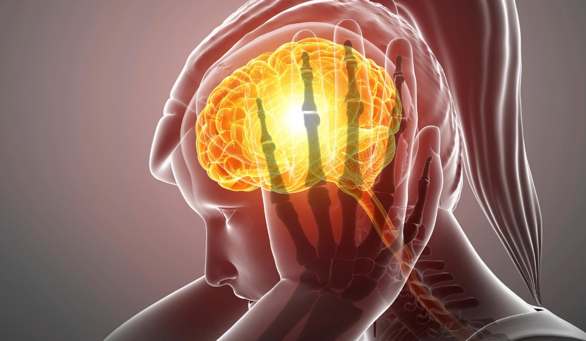 Understanding Migraines: Causes, Effects, and Relief Strategies